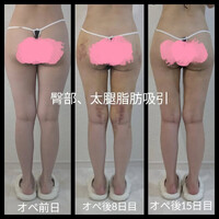 画像281