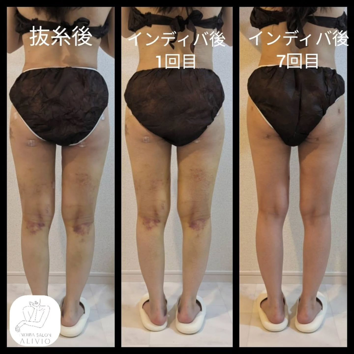 画像294
