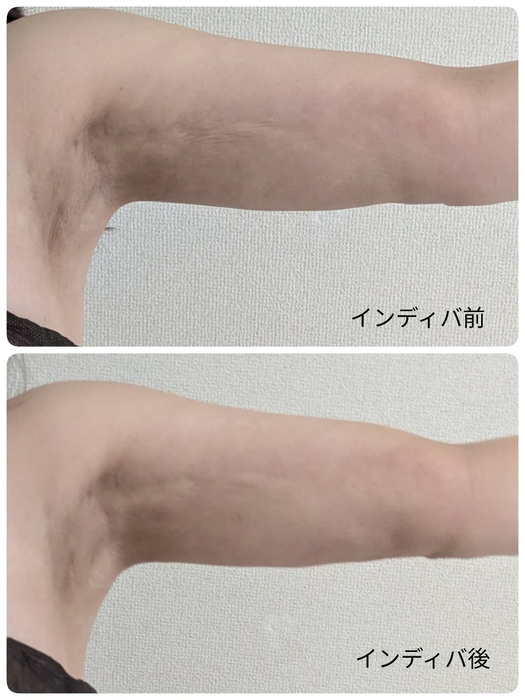 画像399