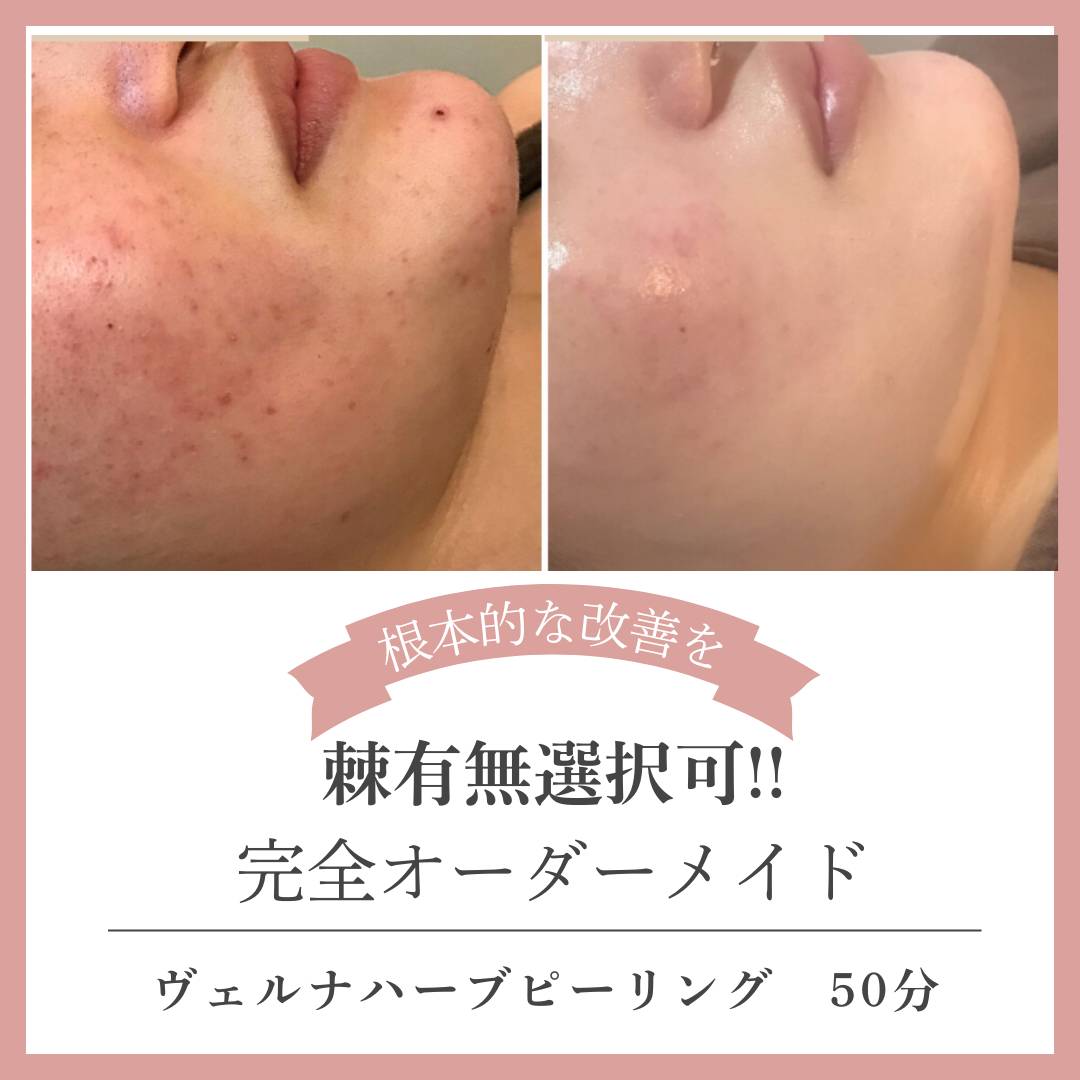 毛穴レスのクリア肌を手に入れよう！