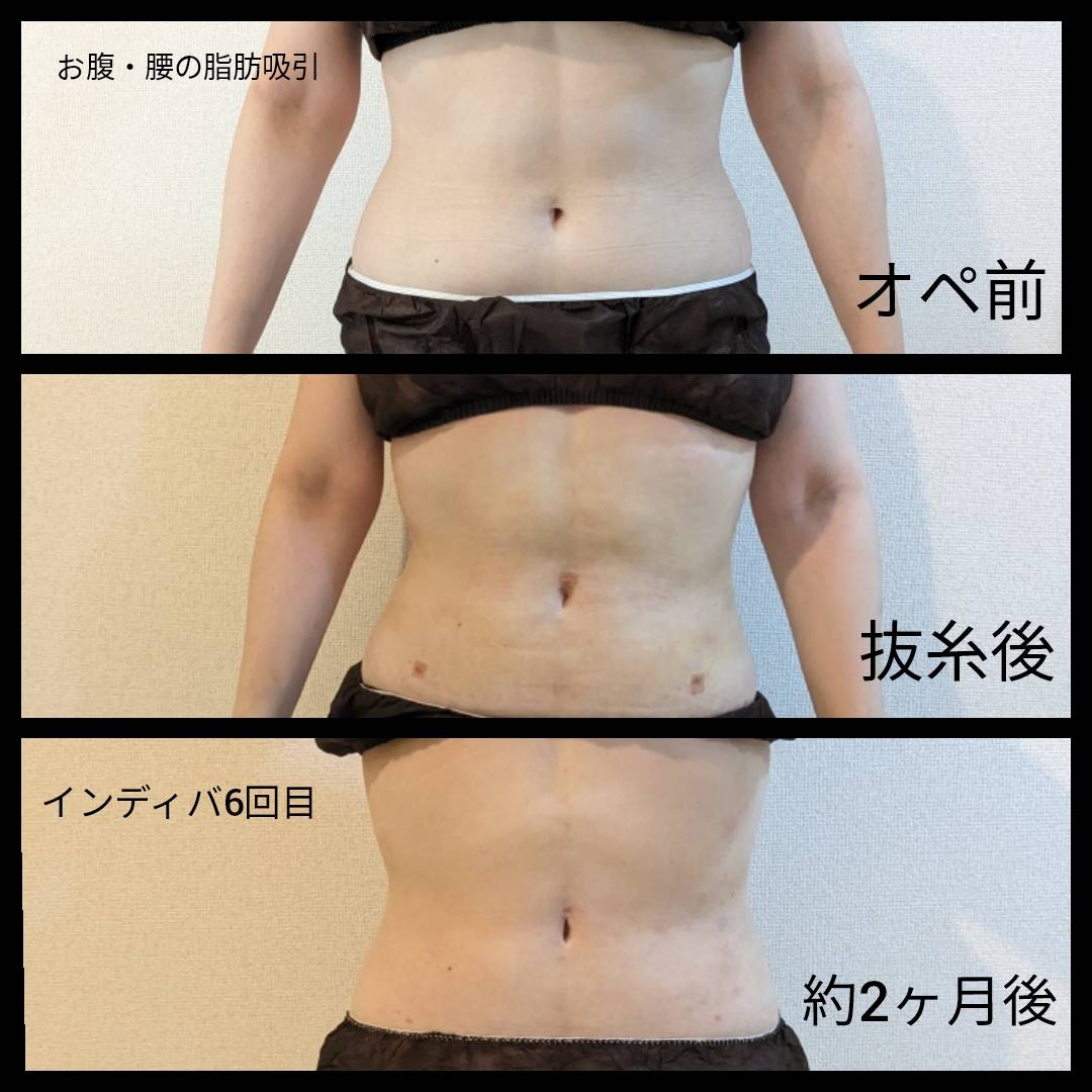 今すぐ予約・お問い合わせ