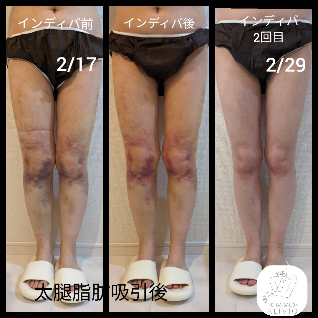 今すぐ予約しよう！