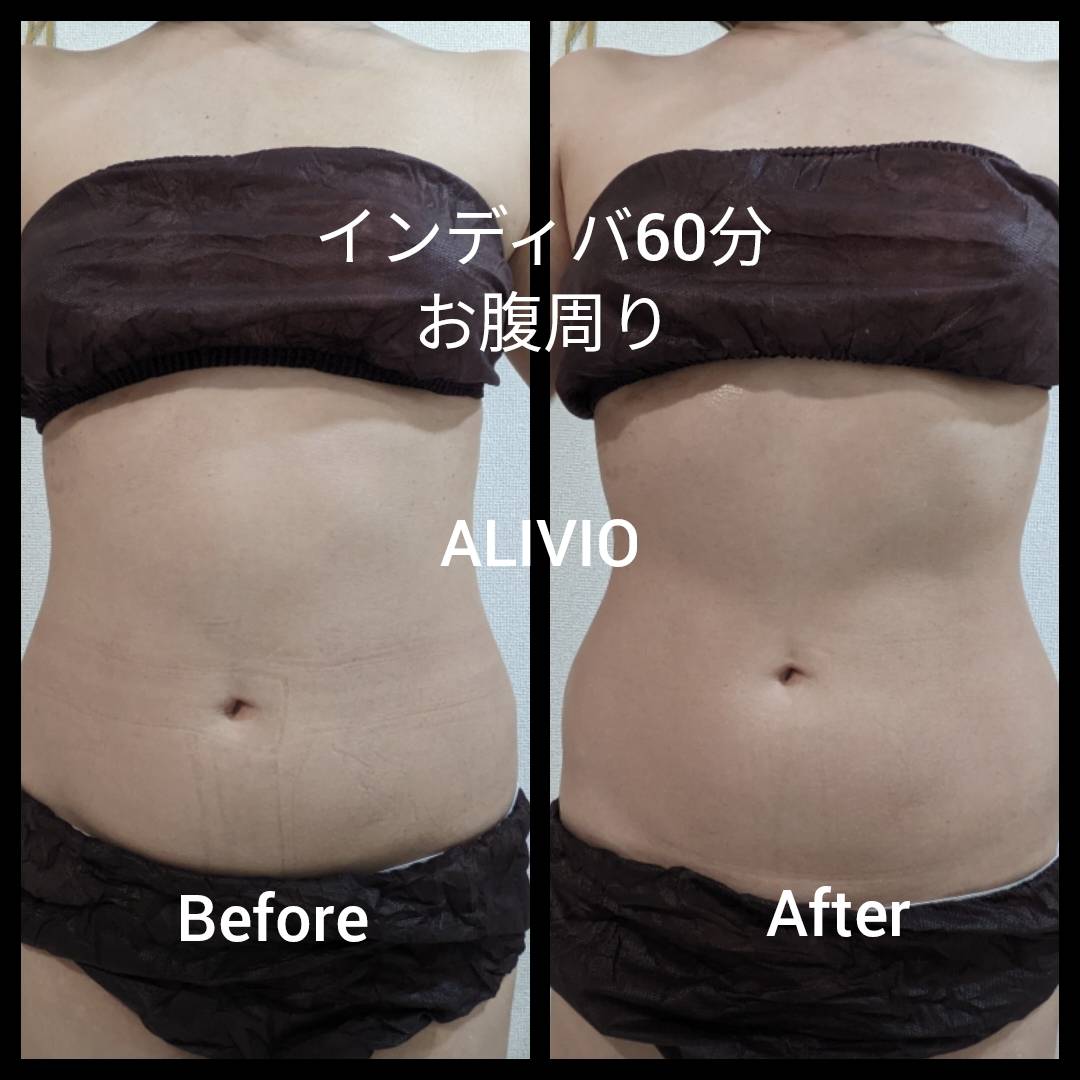 今すぐ予約！