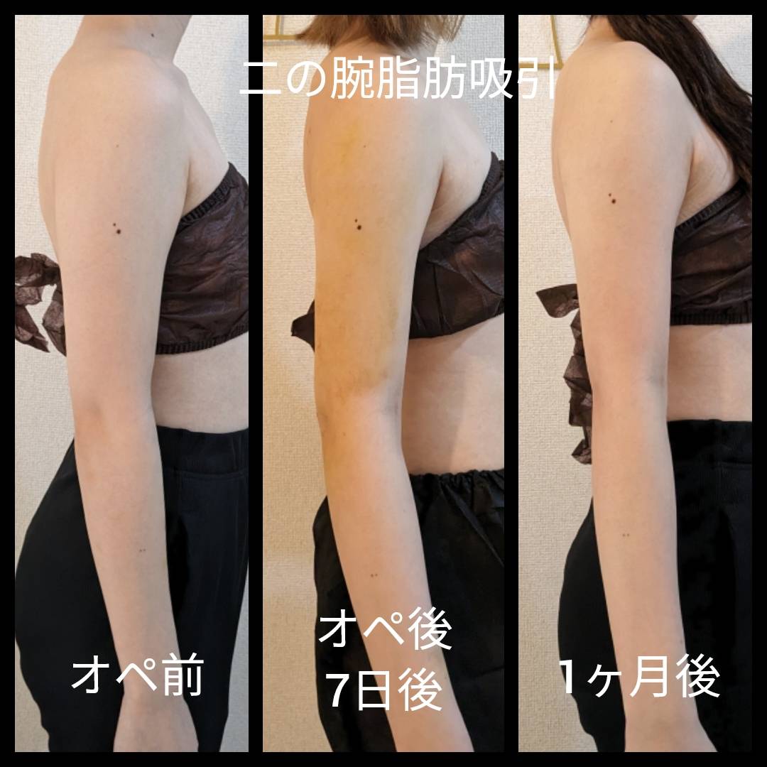 2. インディバの効果とは？